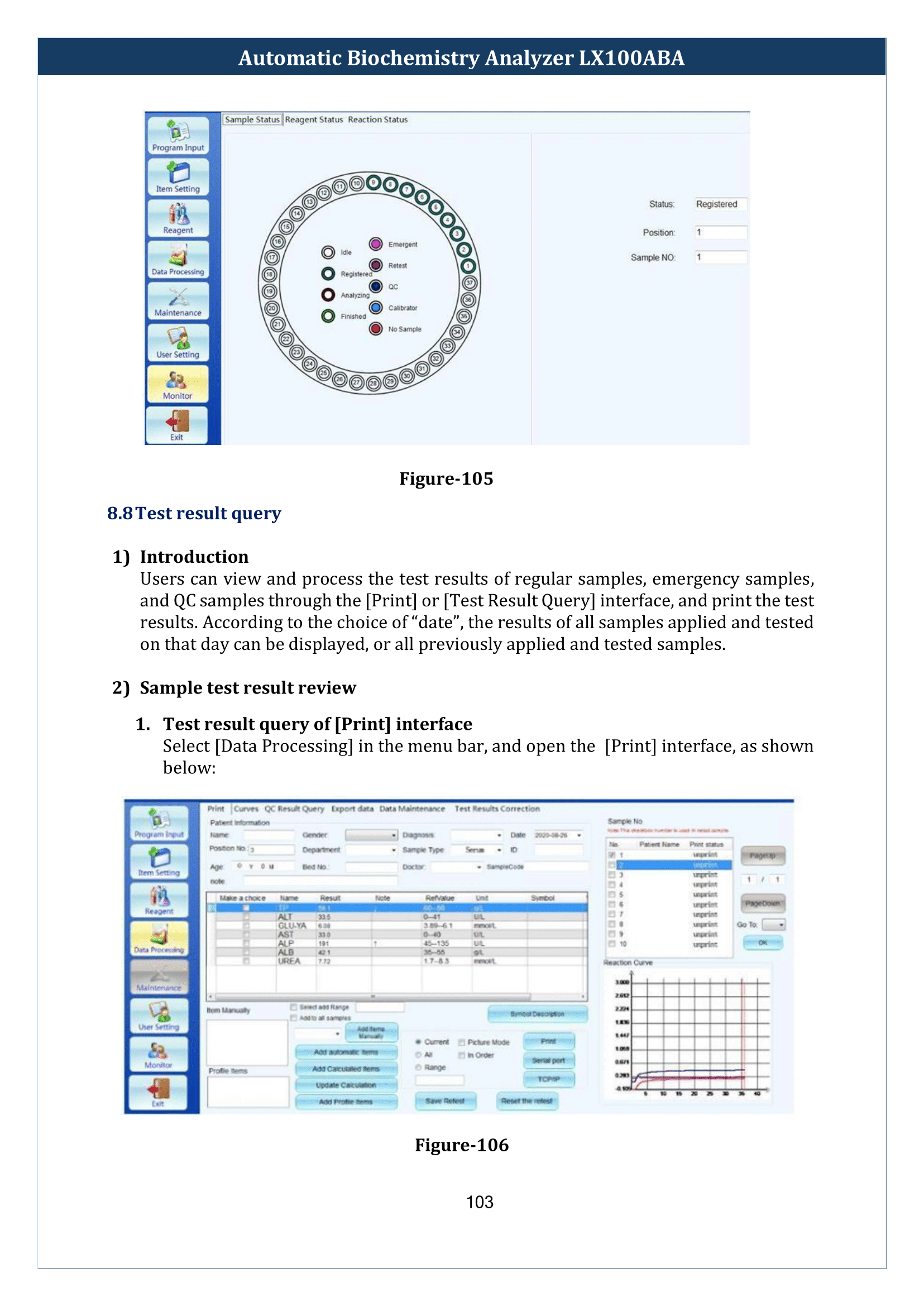 Automatic-Biochemistry-Analyzer-LX100ABA-104.png